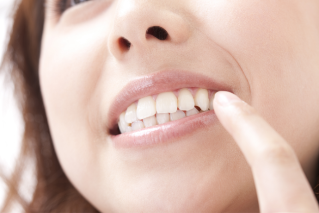 宝田歯科クリニックの審美治療